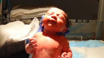 Birth Injury Statistics that May Surprise You 