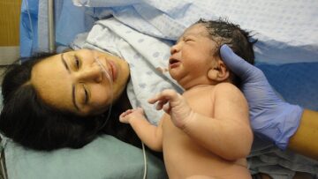 Can a C-Section Lead to Birth Injury? 