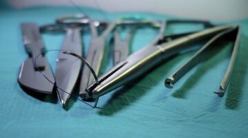 common surgical errors