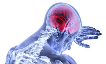 The Danger and Detriment of Strokes